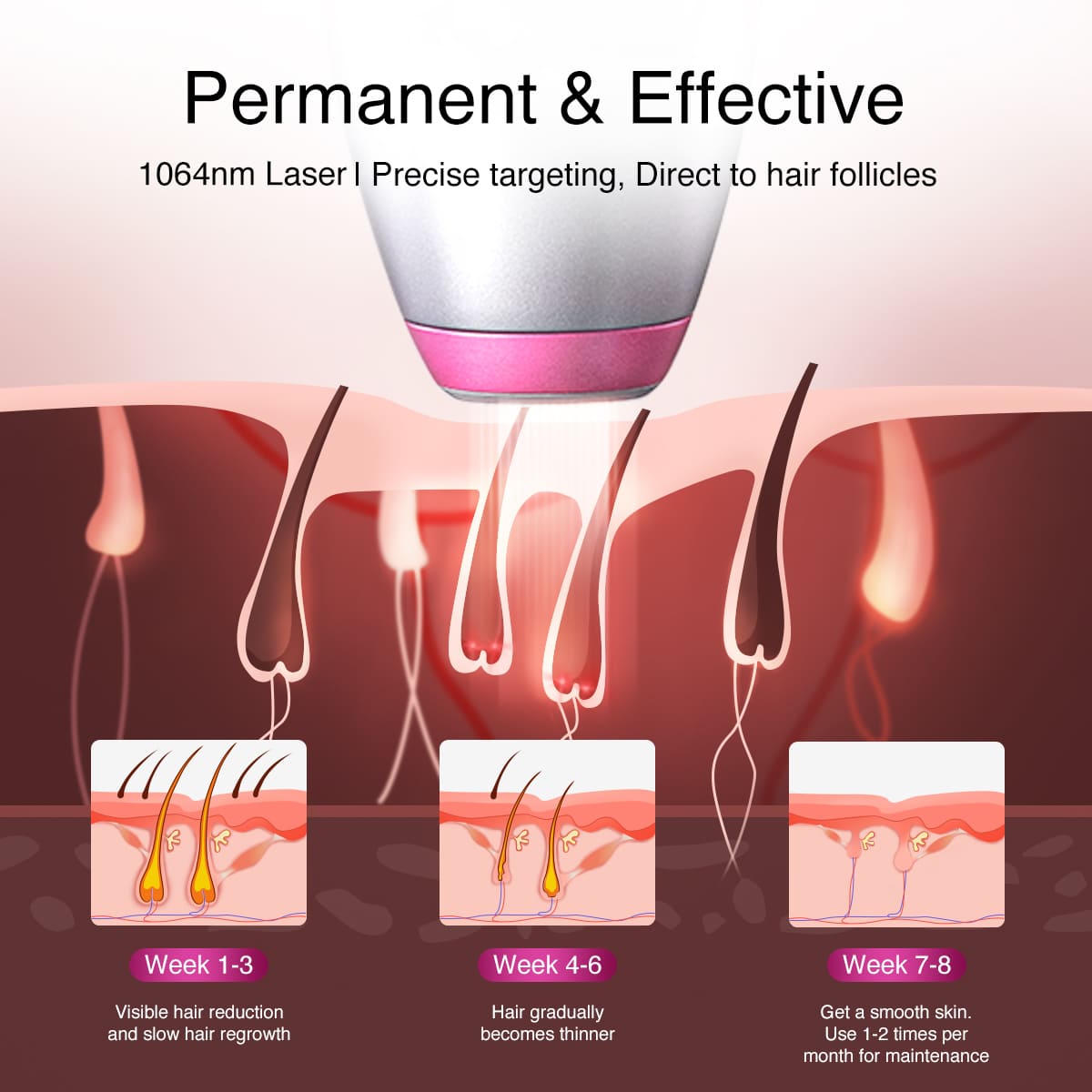 DermRays V6S Diode Laser Hair Removal, 1064nm, Specifically For Dark Skin